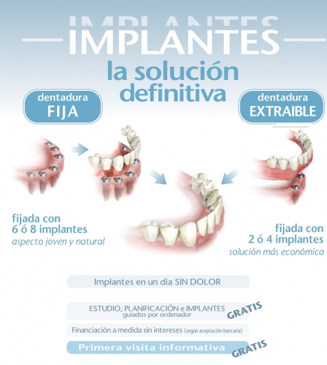 Josefina Arce Llupia-12