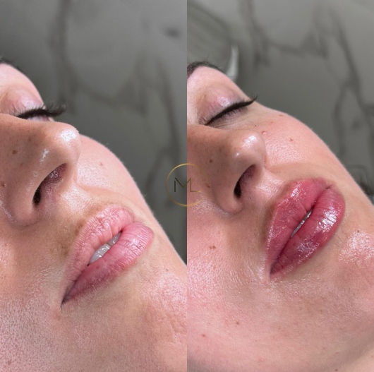 Margherita Lauriano-1