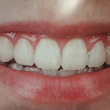 Acercar imagen: Lourdes Vargas Aceituno, Dentista Daimiel