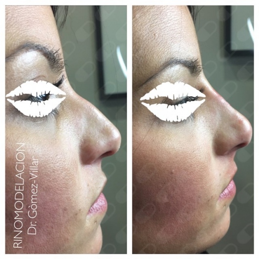 Jose Manuel Gomez Villar-11