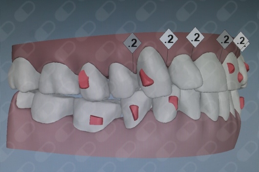 Laura Junquera Alfayate-0