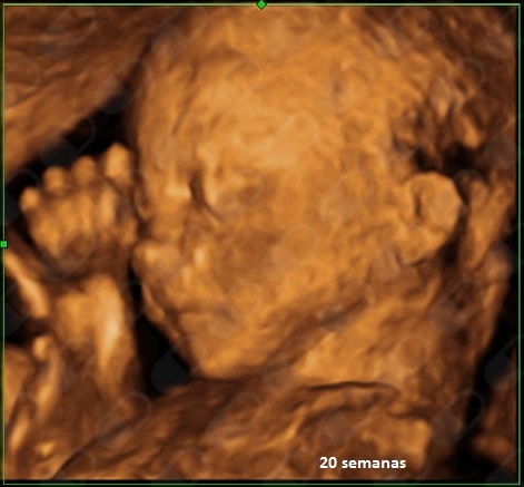 Irene Vico Zúñiga-5