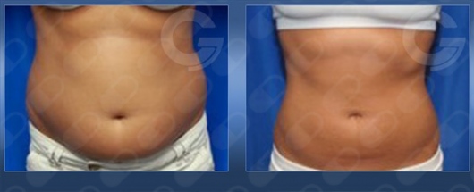 Alejandra Junoy Sainz-7