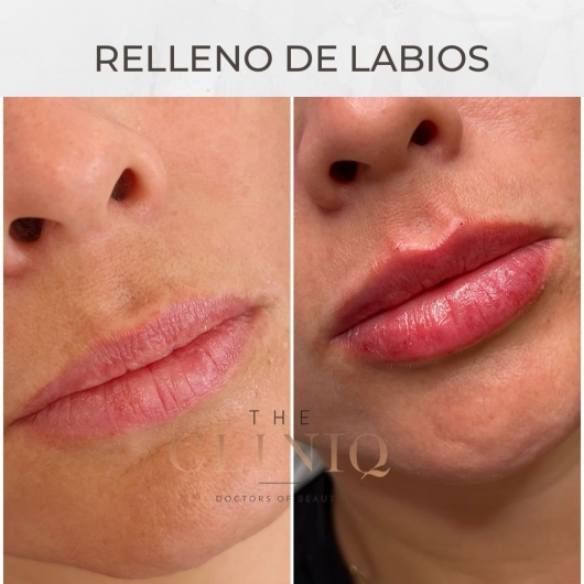 Mireia Gorriz Martinez-1