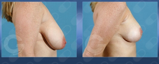 Alejandra Junoy Sainz-4