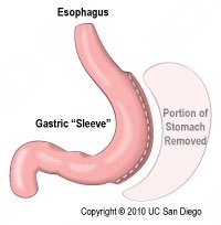 Ramiro Amurrio Fernandez-1