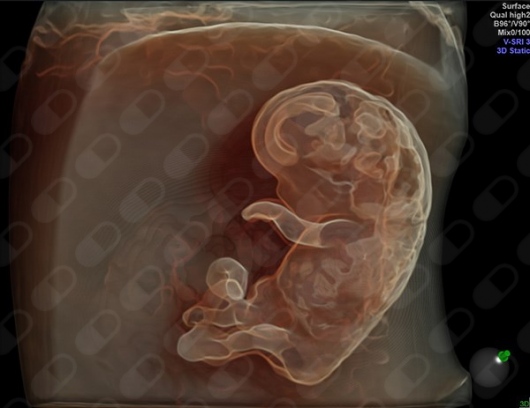 Guillermo Ripoll Humet-8