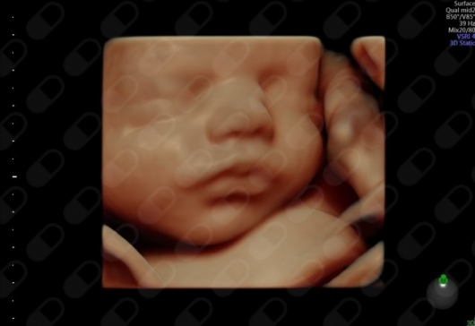 Guillermo Ripoll Humet-7