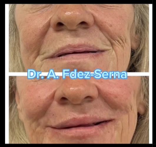 Andrés Fernández Serna-4