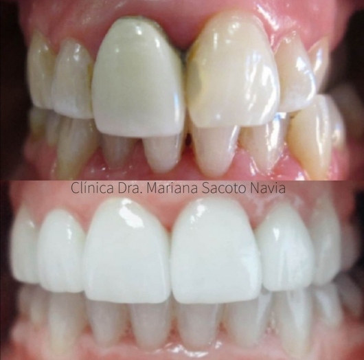 Mariana Sacoto Navia-6