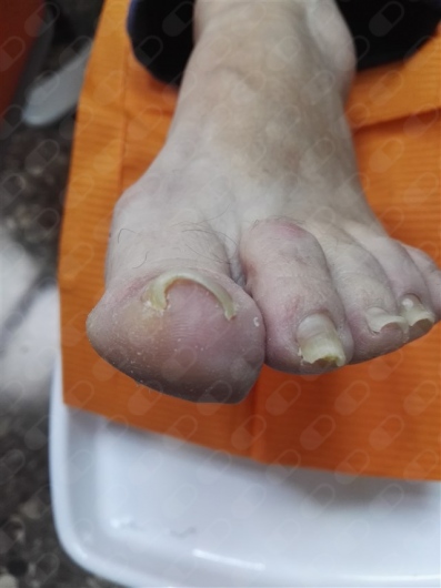 Juan Jose Martinez Bertolin-11