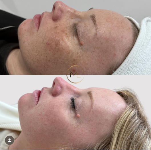 Margherita Lauriano-2