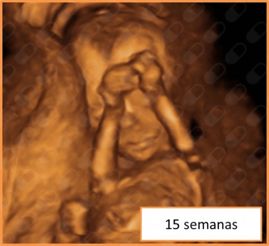 Irene Vico Zúñiga-2