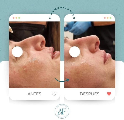 Aida Flores Álvarez-1