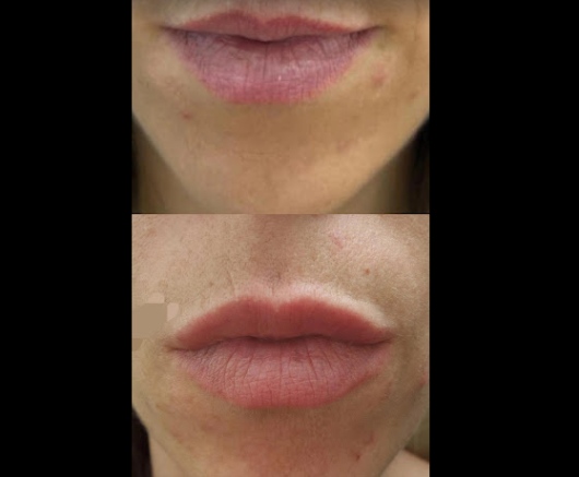 Yanela Orozco Castro-0