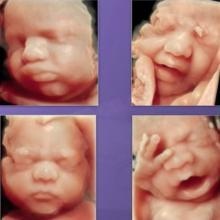 Acercar imagen: Manuel Enrique Matallana López, Ginecólogo Badajoz