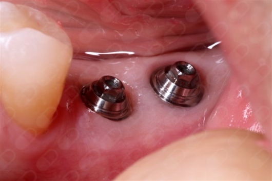 Paco Dominguez Moreno-11