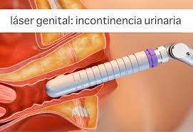 Esperanza García Fulgencio-0