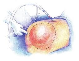 Francisco Miguel Jiménez Armenteros-8