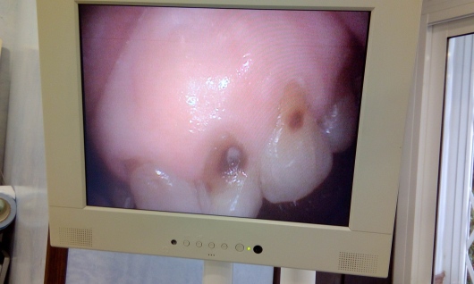 Josefina Arce Llupia-22