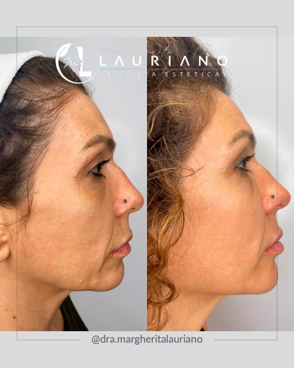 Margherita Lauriano-6