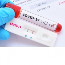 Acercar imagen: Clínica María 3 Test Covid-19, Covid Test Marbella