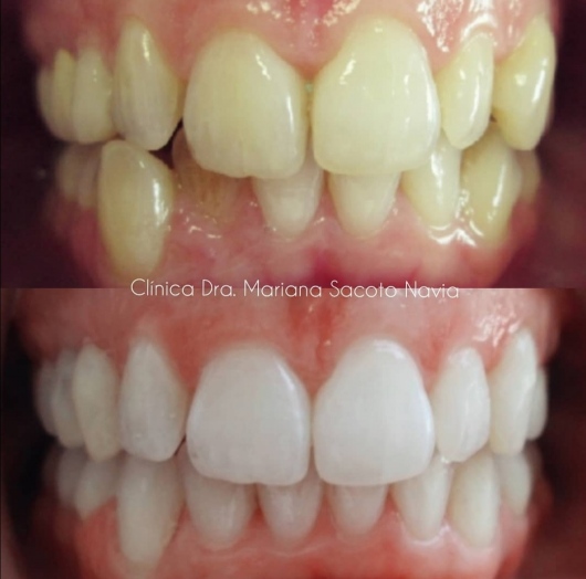 Mariana Sacoto Navia-35