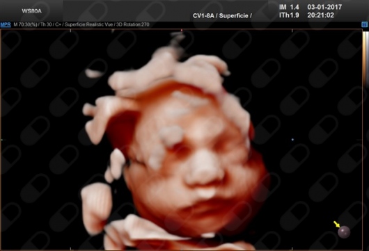 Marc Josep Cahuana Bartra-7