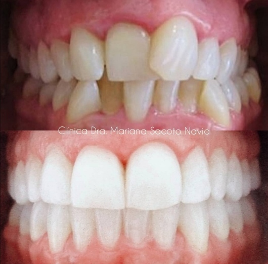 Mariana Sacoto Navia-39