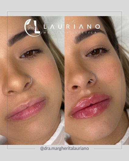 Margherita Lauriano-9