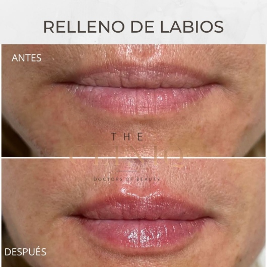 Mireia Gorriz Martinez-0