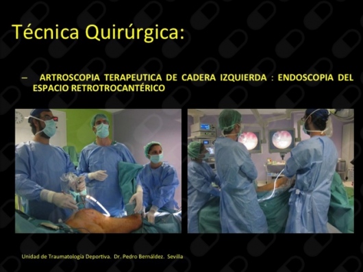 Pedro Bernáldez Domínguez-9