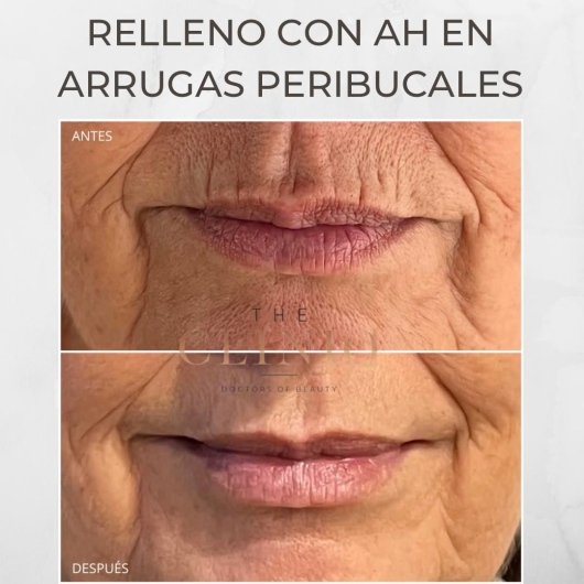 Mireia Gorriz Martinez-2