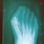 Acercar imagen: Lorena Martínez Seijas, Podólogo Milladoiro