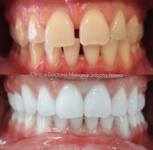 Mariana Sacoto Navia-21