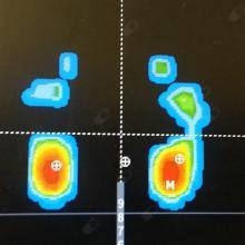 Acercar imagen: Jesus Javier Marchan Martin de la Sierra, Podólogo Madrid