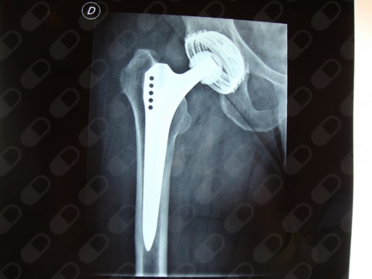 Josep Pous Barral-23