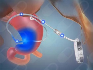 Ramiro Amurrio Fernandez-0