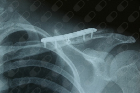 Martín Ballesteros-4