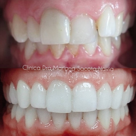 Mariana Sacoto Navia-15