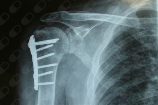 Martín Ballesteros-3