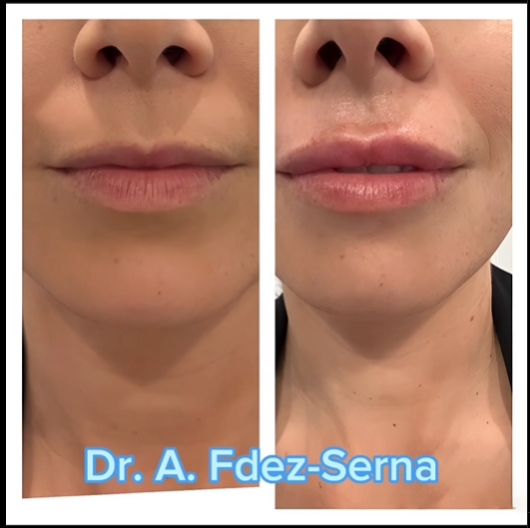 Andrés Fernández Serna-5