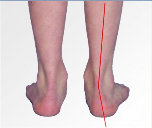 Mirja Marco Bendtsen-8