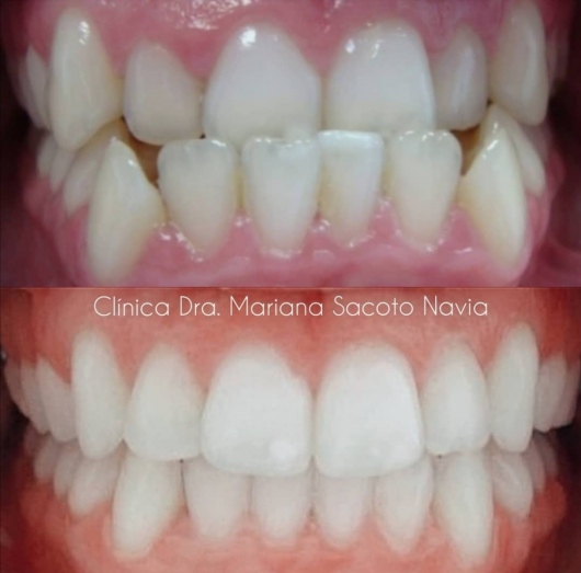 Mariana Sacoto Navia-30