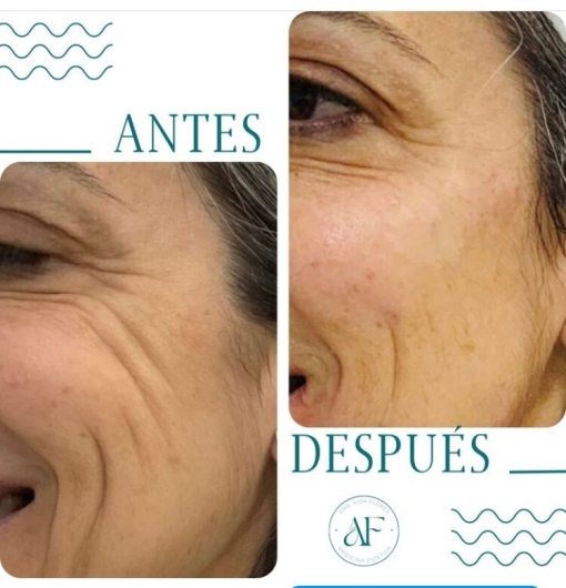 Aida Flores Álvarez-0