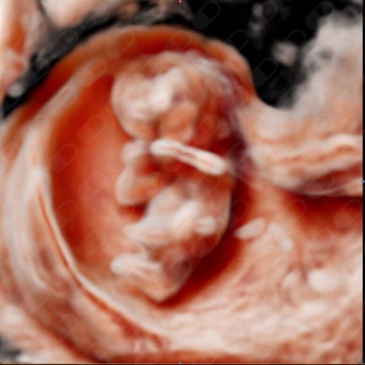 Marc Josep Cahuana Bartra-5