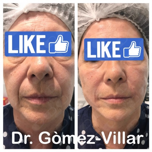 Jose Manuel Gomez Villar-9