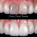 Clínica Dental BenaluaAlgorfa - 