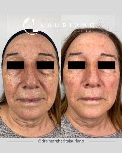 Margherita Lauriano-7