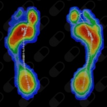 Estudio Biomecanico Pisada Deportistas